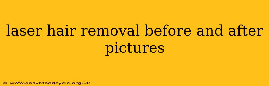 laser hair removal before and after pictures