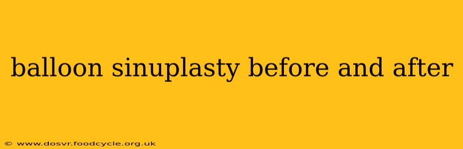 balloon sinuplasty before and after