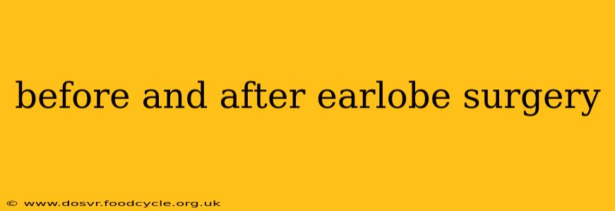 before and after earlobe surgery