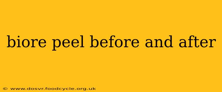 biore peel before and after