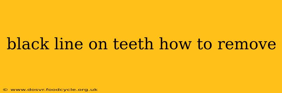 black line on teeth how to remove