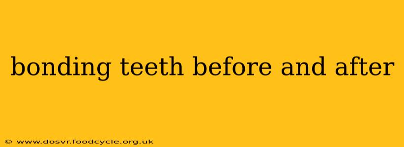 bonding teeth before and after