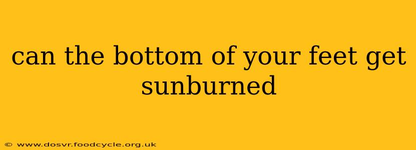 can the bottom of your feet get sunburned