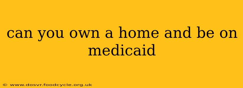 can you own a home and be on medicaid