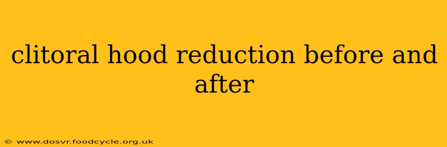 clitoral hood reduction before and after