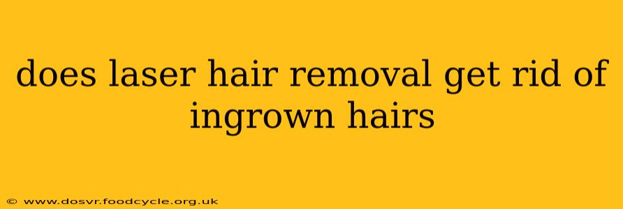 does laser hair removal get rid of ingrown hairs