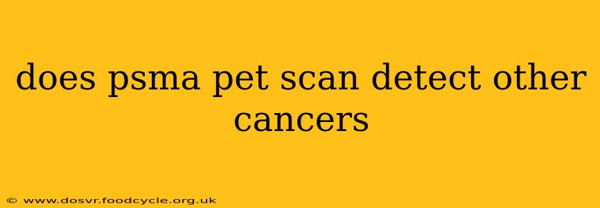 does psma pet scan detect other cancers