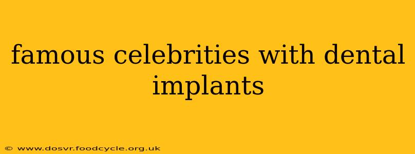 famous celebrities with dental implants