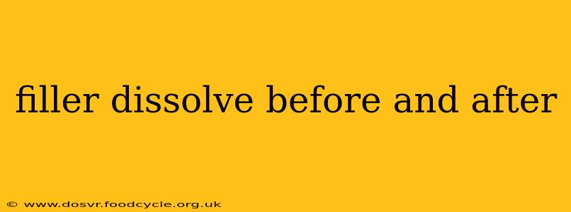 filler dissolve before and after