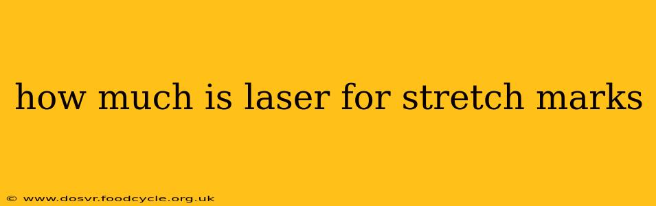 how much is laser for stretch marks