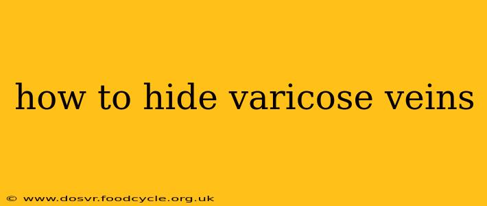 how to hide varicose veins