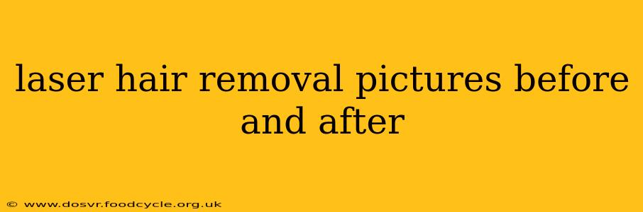 laser hair removal pictures before and after