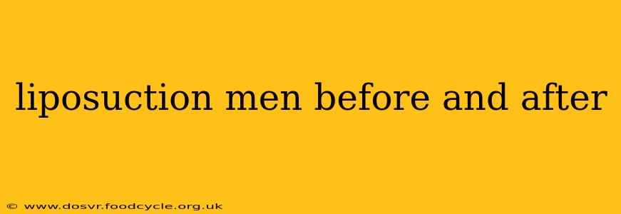liposuction men before and after