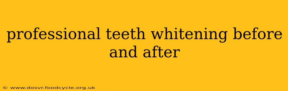 professional teeth whitening before and after