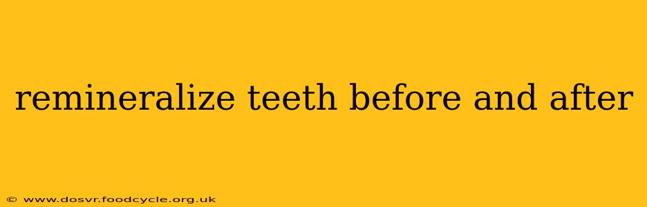 remineralize teeth before and after