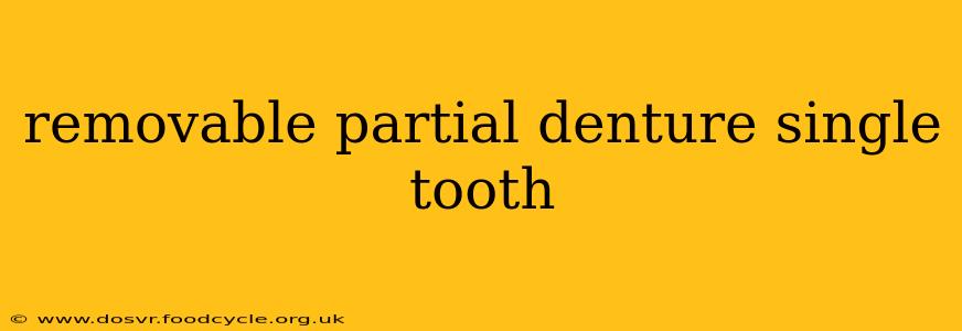 removable partial denture single tooth