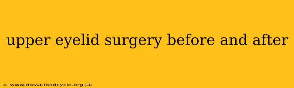 upper eyelid surgery before and after