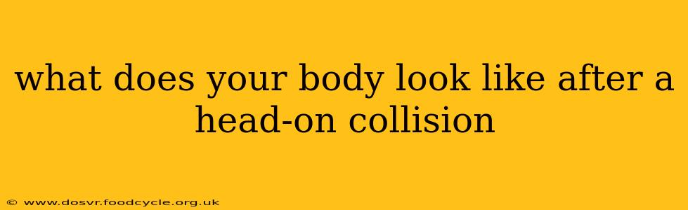 what does your body look like after a head-on collision