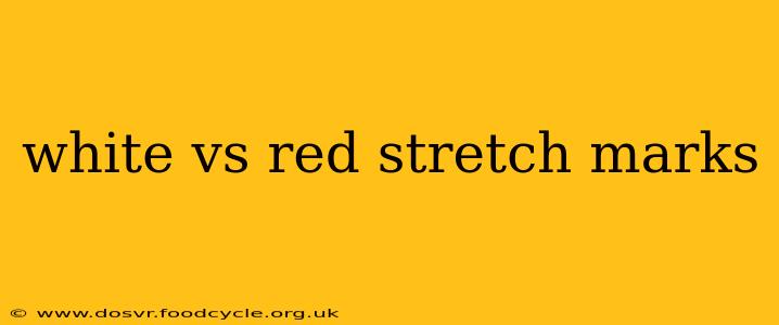 white vs red stretch marks