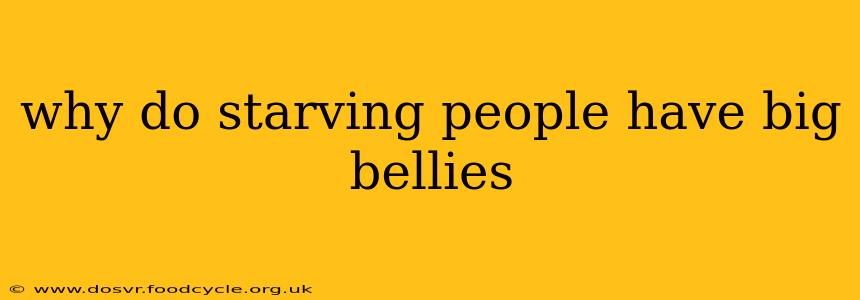 why do starving people have big bellies