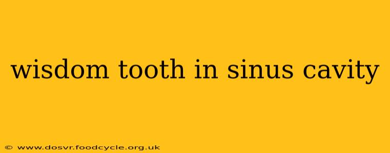 wisdom tooth in sinus cavity