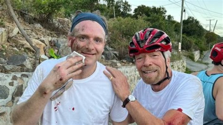 66-Year-Old Daredevil Richard Branson Crashes Bike And Breaks His Face